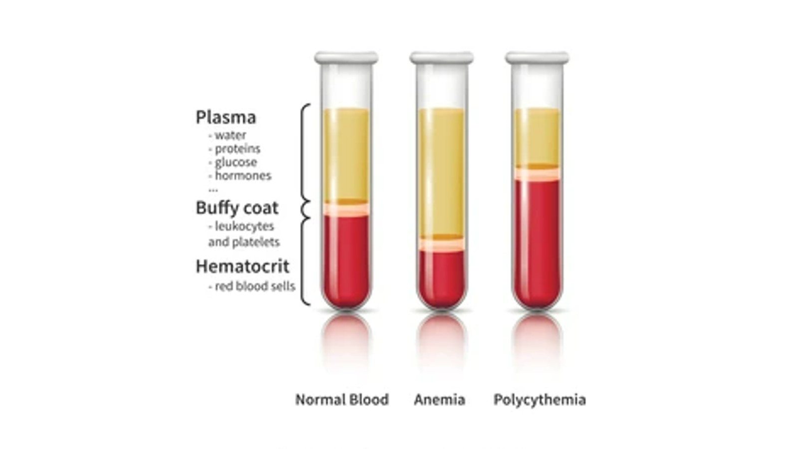 Polisitemia